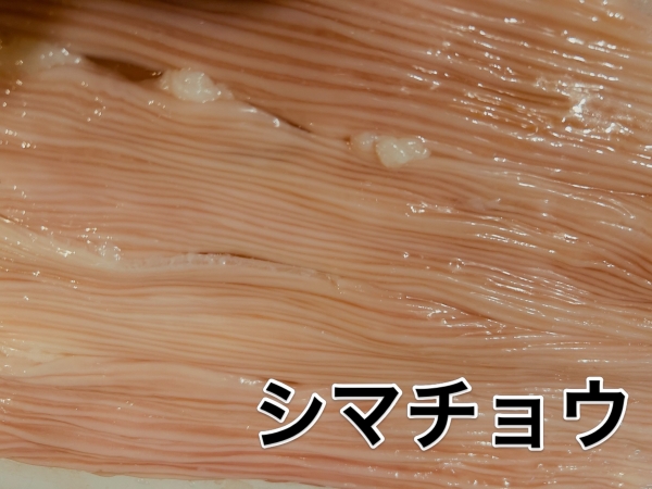 大腸